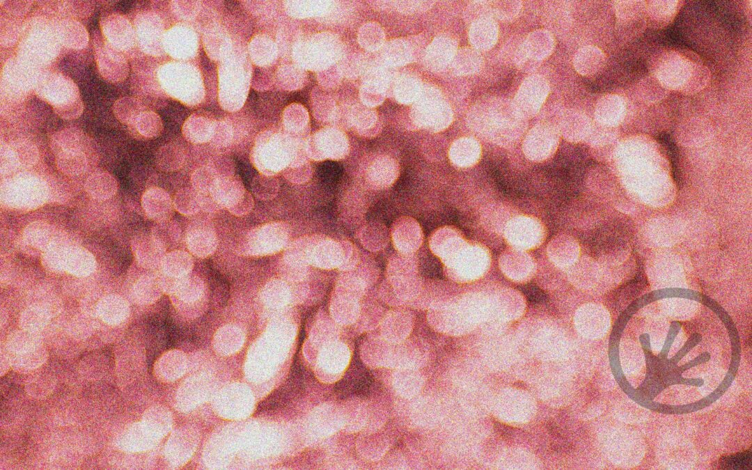 Microbiome analysis: Correlation is not causation
