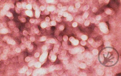Microbiome analysis: Correlation is not causation
